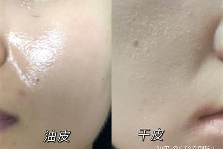 龙沙宝石种植方法及注意事项