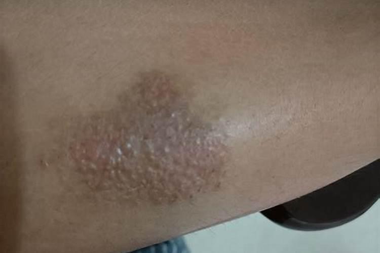 葡萄在秧子上快能吃的时候葡萄开始委缩而且葡萄梗就开始黑是什么...