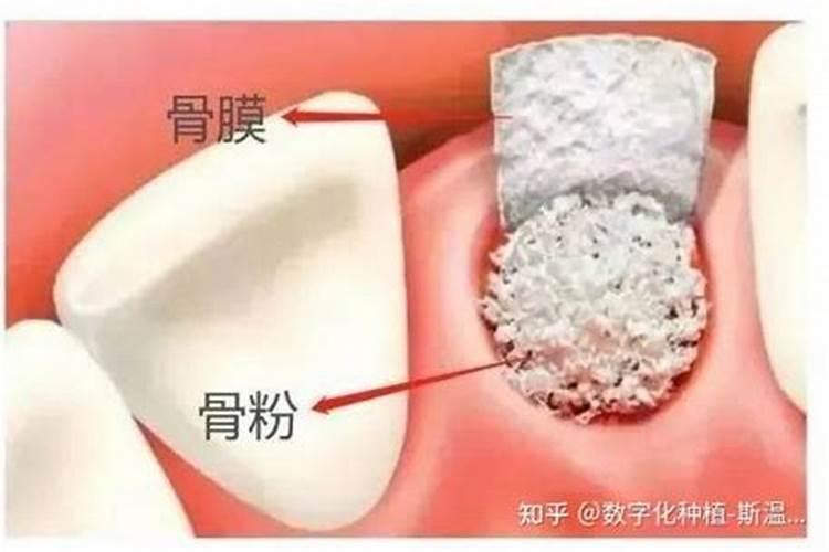 柑橘靠接长芽打什么叶面肥？