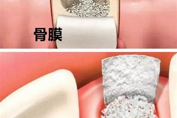 骨粉适合什么蔬菜当肥料