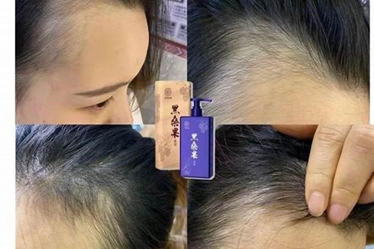氨基酸水溶肥使用禁忌