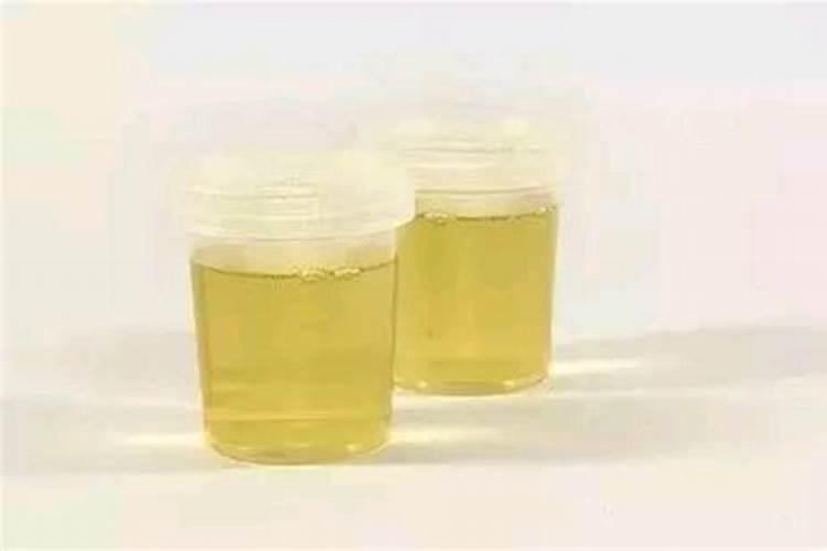 尿可以当肥料浇菜吗