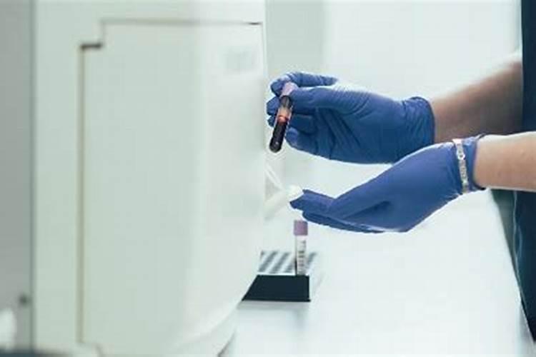 苹果树缺钙的原因都有哪些,该怎样识别是不是缺钙？