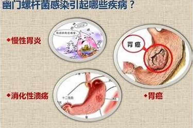 博润科技探索氮肥增效剂——NBPT脲酶抑制剂&DMPP硝化抑制剂的奥秘