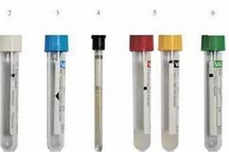 不同颜色的采血试管有哪些？它们的作用又是什么？