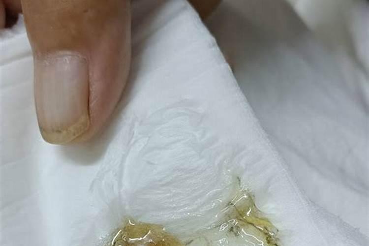 鱼汤怎么变白的原理