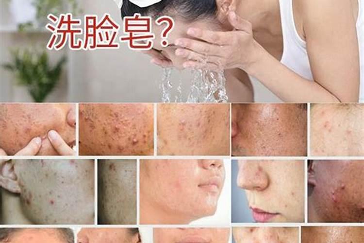 苹果的苦痘病要怎样防治？