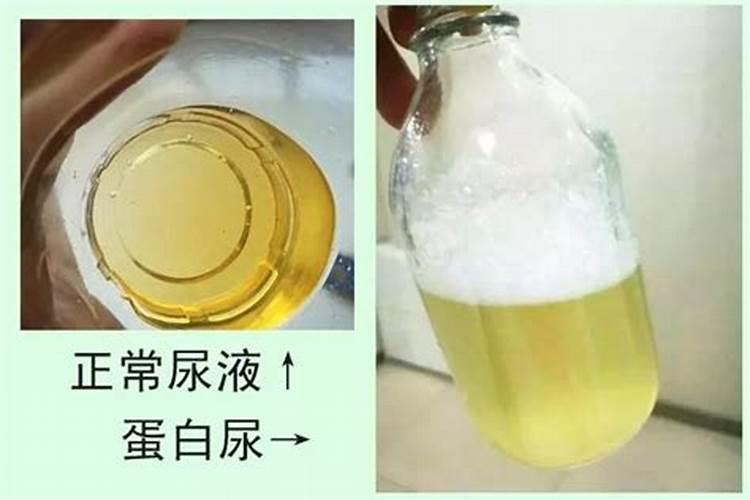 人尿是有机肥还是无机肥？