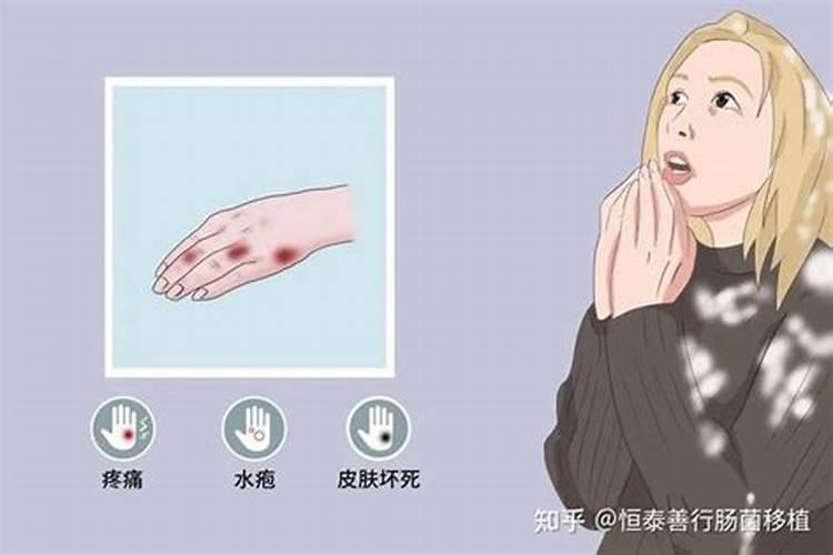 鱼蛋白自制配方比例