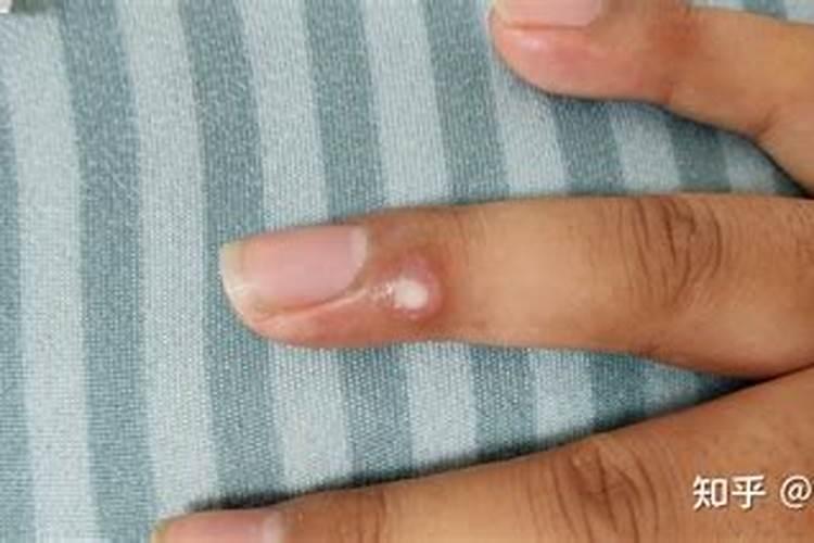 气相液氮罐的使用？