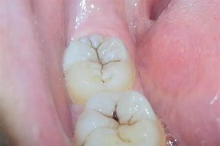 大蒜采收蒜苔后如何管理？