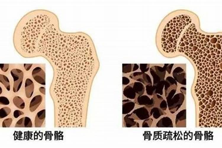 种植香蕉,作物缺钙,过磷酸钙含钙吗？用过磷酸钙或者钙镁磷能补钙补镁...
