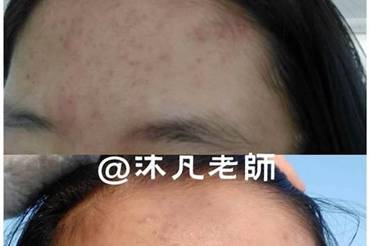 果树叶面施肥小技巧,你了解吗？