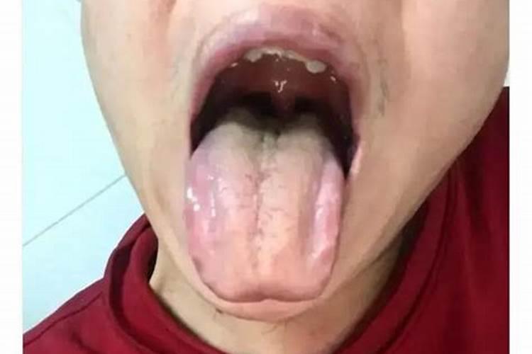 身上哪些地方要是出了问题,舌苔就会变得“肥厚”？