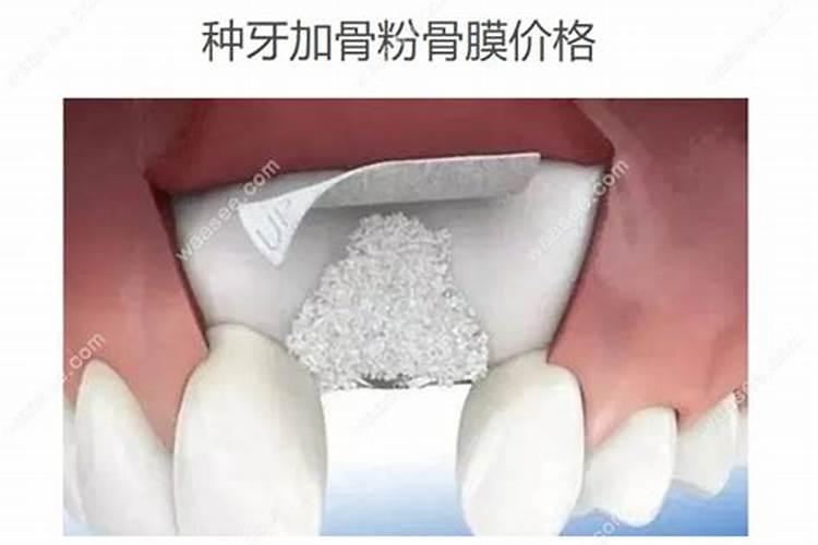 骨粉高钙肥真的那么好吗