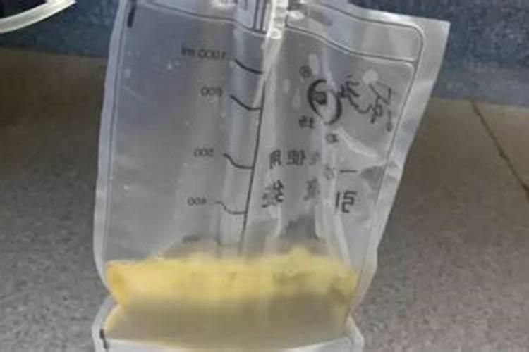 人尿是不是能够当作氮肥