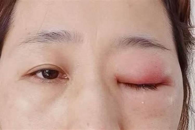 滴水观音有毒吗？