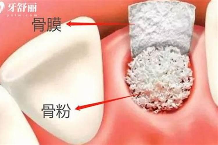 骨粉适合什么花当肥料、骨粉肥的注意事项