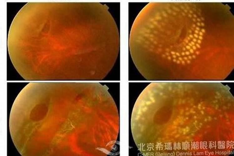 香瓜叶子上有黄斑,然后整体不生长枯萎了怎么办？