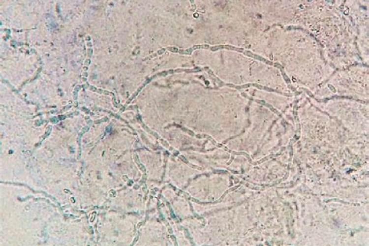 氧化钾和硫酸钾哪个好