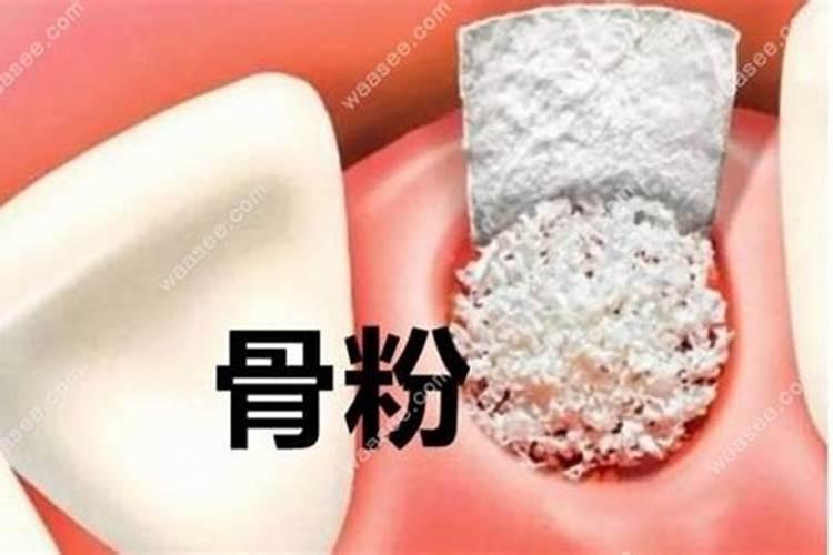 什么花喜欢骨粉肥哪些花适合用骨粉
