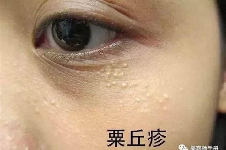 要怎样操作才可以把鱼蛋白过滤出来