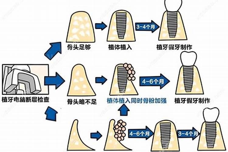 水溶肥的使用方法