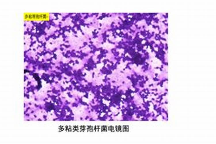 最新打炭疽病的药,盘点6种疗效最佳药液