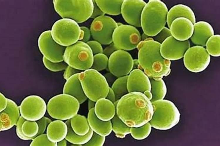 铁树用什么肥料