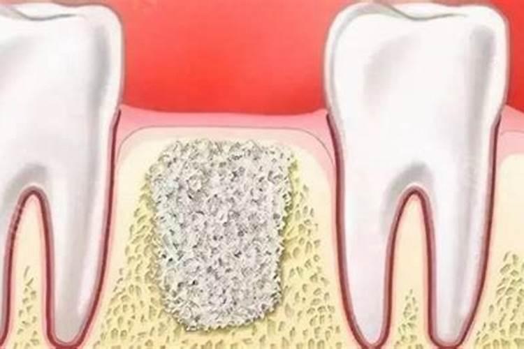 骨粉肥料的作用