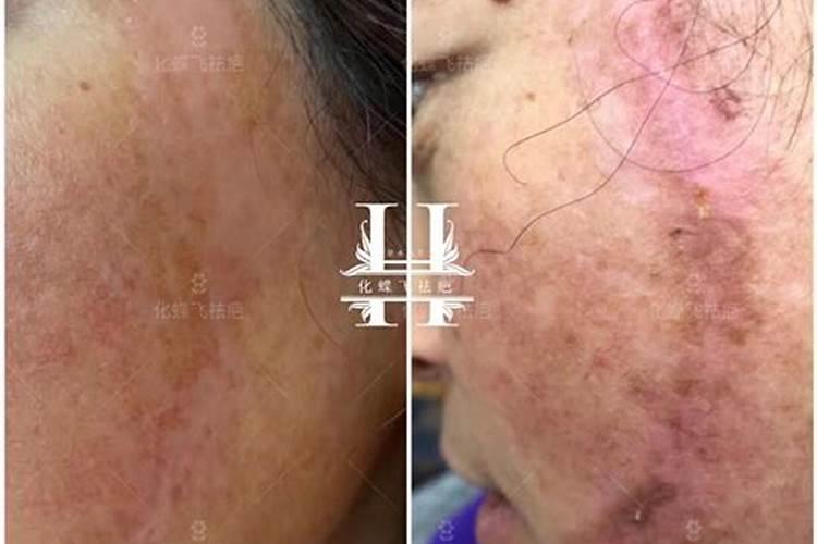 好艾多点亮健康未来:养护好血管做好这三招!