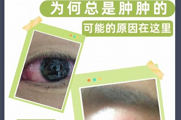 上眼皮肿是怎么回事那