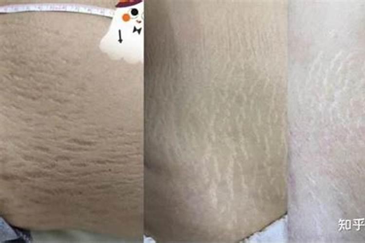 养一只鱼骨纹金渐层有哪些需要注意的方面？