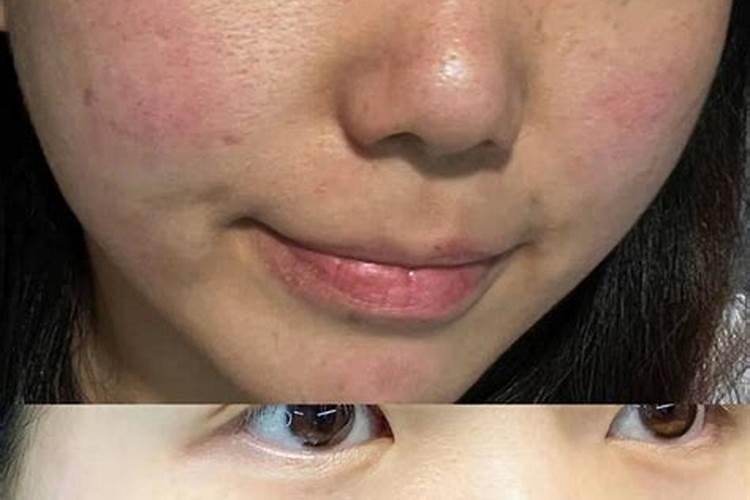 缅甸西瓜瓜瓤发粉发白怎么回事？