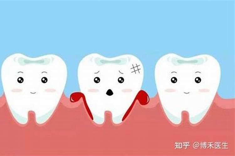 氟斑牙怎么去除