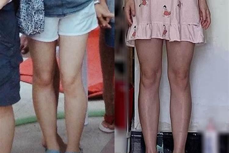为什么小腿比大腿粗小腿跟大腿一样粗该怎么减肥