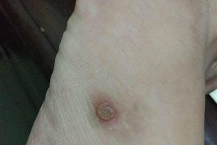 草莓发生红中柱根腐病如何防治？草莓重茬根腐用什么肥料好？