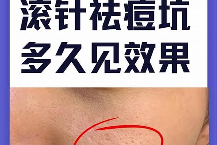 西瓜施肥比例是多少