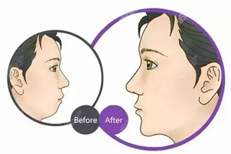 马铃薯应该怎么追肥？