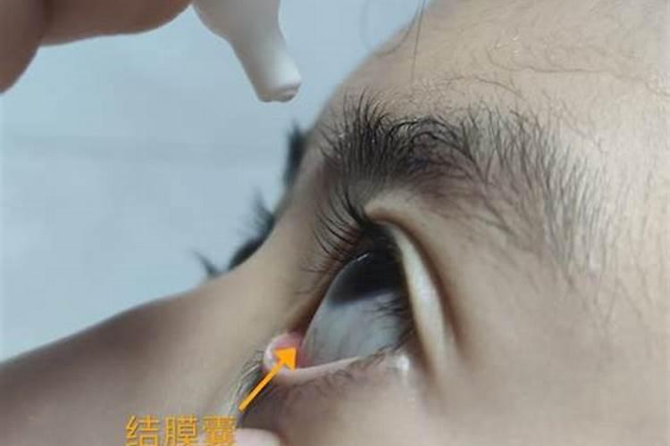 橘子树叶子发黄是怎么回事？怎么办(图)