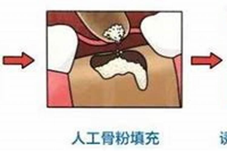 骨粉适合什么蔬菜当肥料