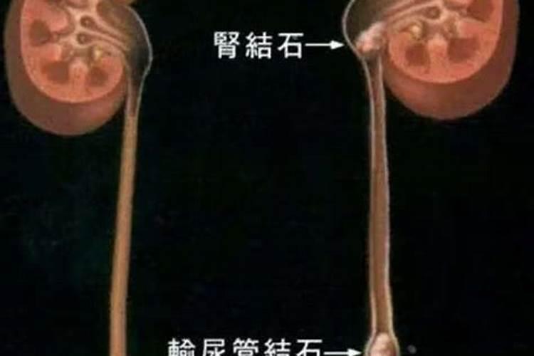 虎尾兰用什么土种较好