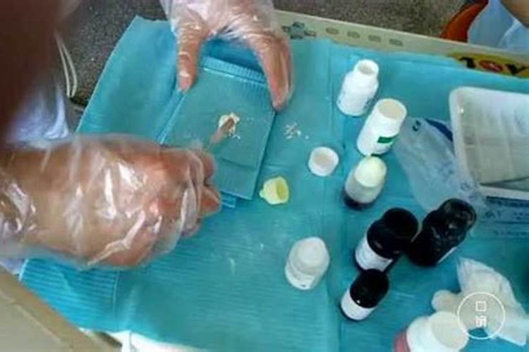 调制磷酸锌水门汀的注意事项有哪些？