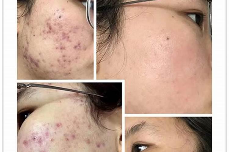 玉米后期追什么肥料好