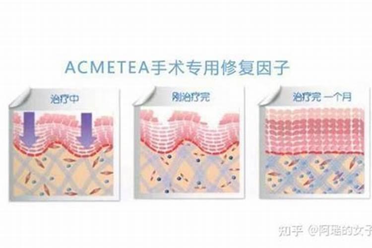 鱼内脏发酵后能交什么花