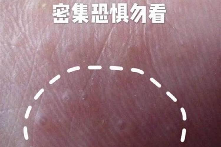 杨树上尿素不会长裂吧