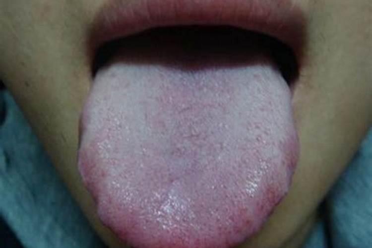 枣树坐果时候可以打;赤霉素胺鲜酯芸苔素吗