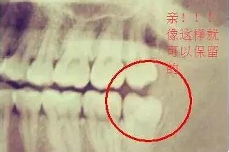 花盆里种的草莓刚出芽施什么肥？