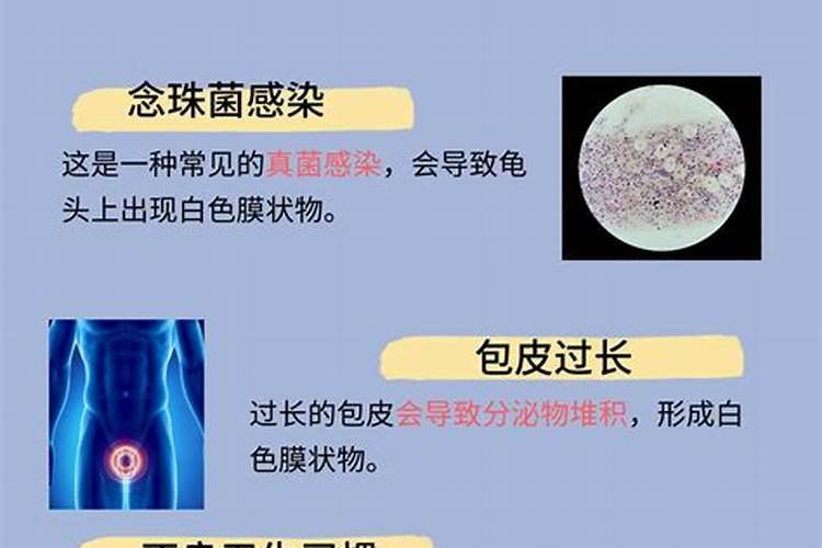 菌肥长白毛的好还是不长的好