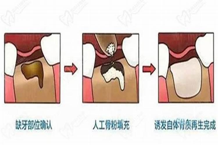 鹿角粉和鹿角霜有区别吗？
